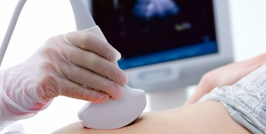 Exame de Ecografia vascular com doppler em Curitiba