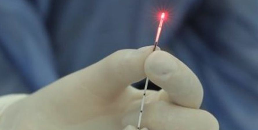 Laser Endovenoso no tratamento de varizes